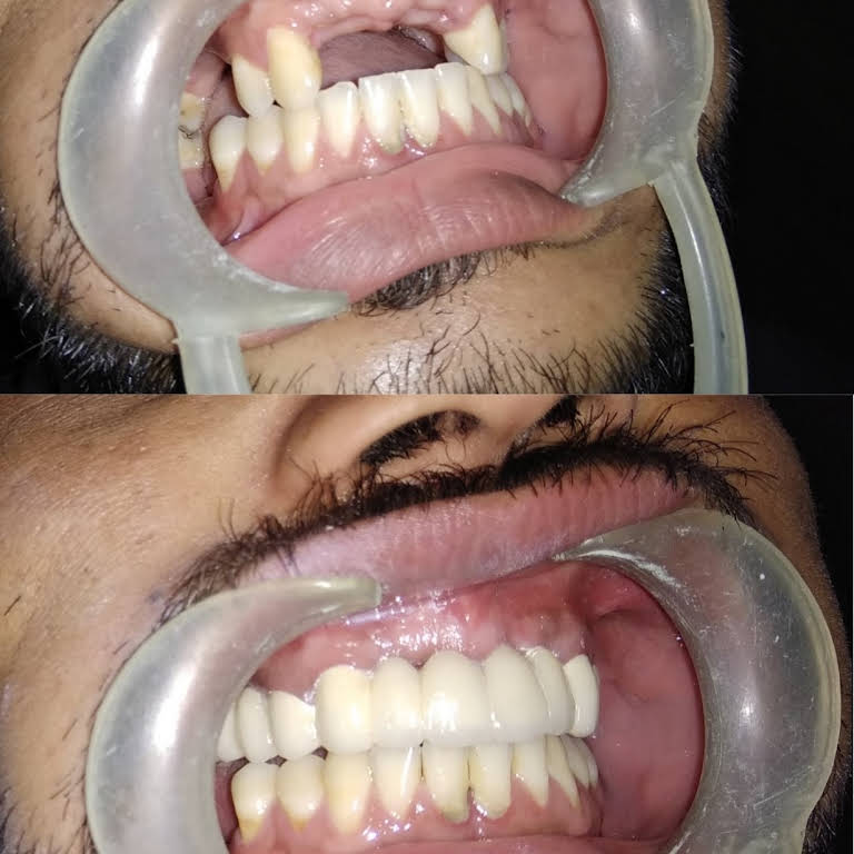 Smile N Shine Dental Care Chemmad