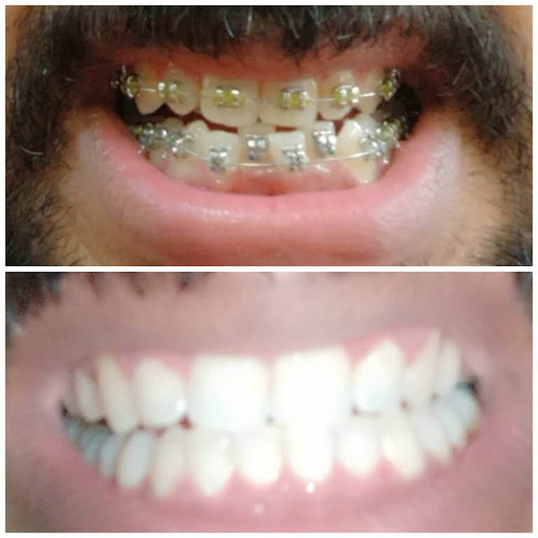 Smile N Shine Dental Care Chemmad