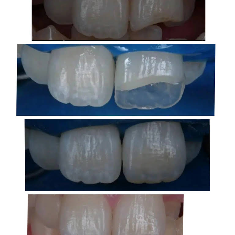 Smile N Shine Dental Care Chemmad