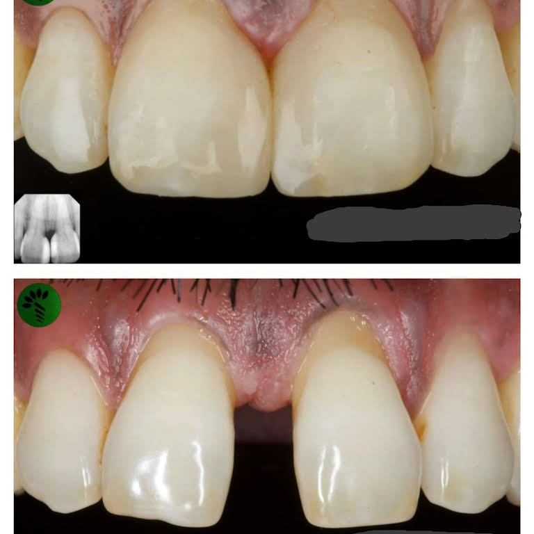 Smile N Shine Dental Care Chemmad