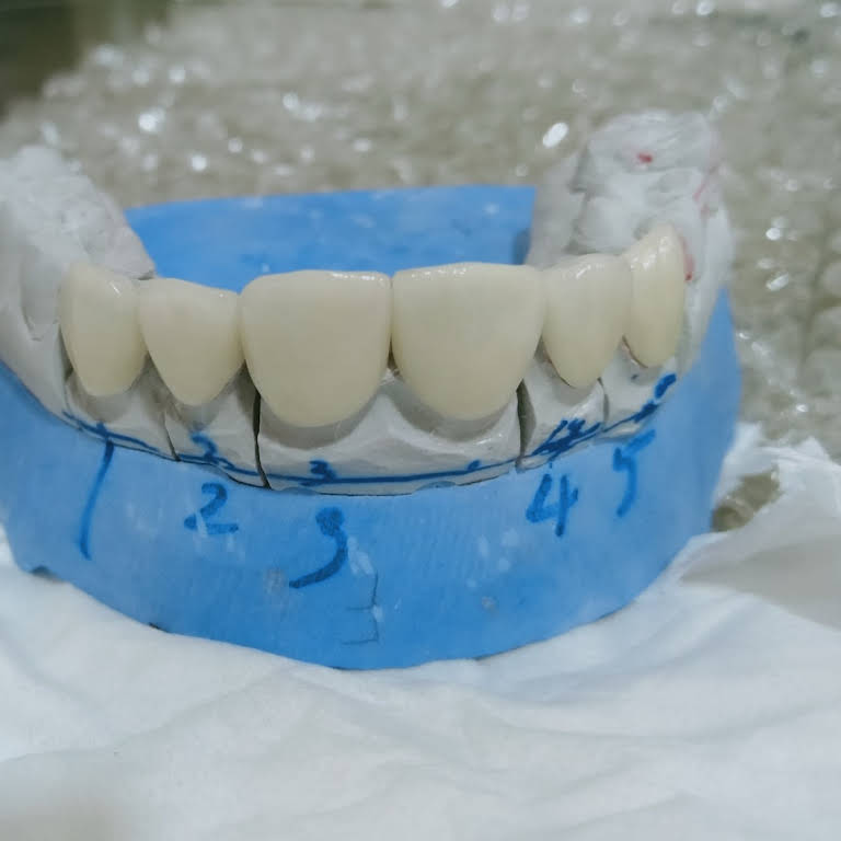 Smile N Shine Dental Care Chemmad