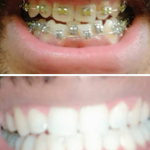 Smile N Shine Dental Care Chemmad