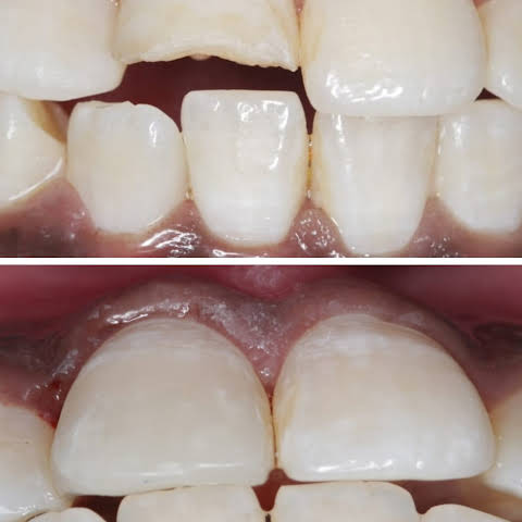 Smile N Shine Dental Care Chemmad